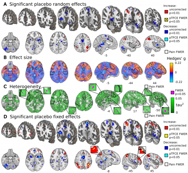 연구팀이 촬영한 뇌 fMRI 영상. 파란색 부분이 뇌 활성이 감소한 부위다. [출처=네이처 커뮤니케이션스(M. Zunhammer)]