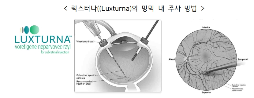 사진: 생명공학정책연구센터의 럭스터나 치료제 보고서