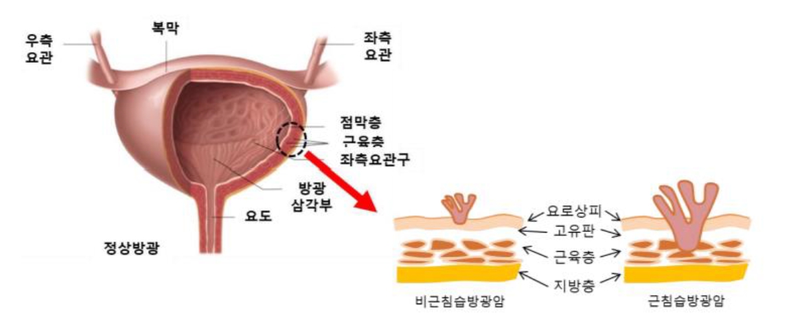 방광 구조(자료: 머크 바이오파마)