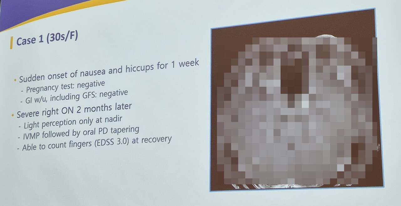 국내 30대 여성 사례