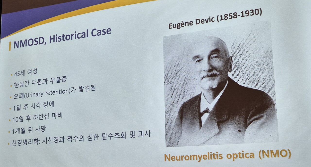 유진 데빅(Eugene Devic)과 첫 번째 시신경 척수염 범주질환 환자 사례