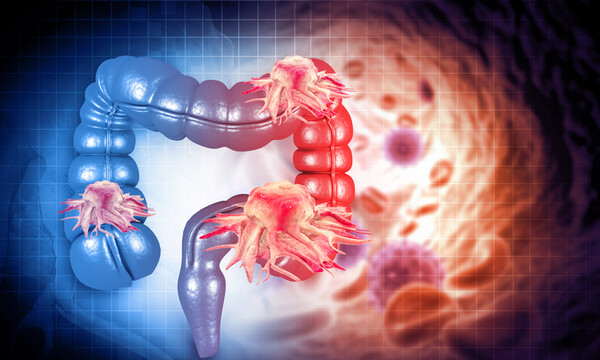 게티이미지 뱅크