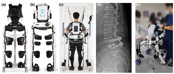 그림. 로봇 보조 보행 훈련 개념 설명 사진. (a) 보행 보조 훈련 로봇 전면 및 (b) 후면. (c) 로봇을 활용해 보행 보조 훈련 중인 환자 후면. (d) 측면 요추 방사선 사진과 (e)척추 보조기를 착용하고 보행 보조 로봇 훈련을 받는 환자 모습.