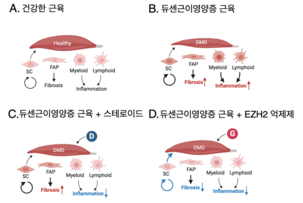 [그림] DMD 동물모델에서 스테로이드와 EZH2 억제제의 근육 재생, 섬유화 및 염증 반응에 대한 효과 비교: (A) 건강한 근육➡ 정상적인 근육 구조 유지, 염증과 섬유화 없음. (B) 듀센근이영양증 근육➡ 근육 손상, 염증과 섬유화 증가. (C) 듀센근이영양증 + 스테로이드➡ 염증은 감소하지만 섬유화 지속. (D) 듀센근이영양증 + EZH2 억제제➡ 염증과 섬유화 동시 감소, 근육