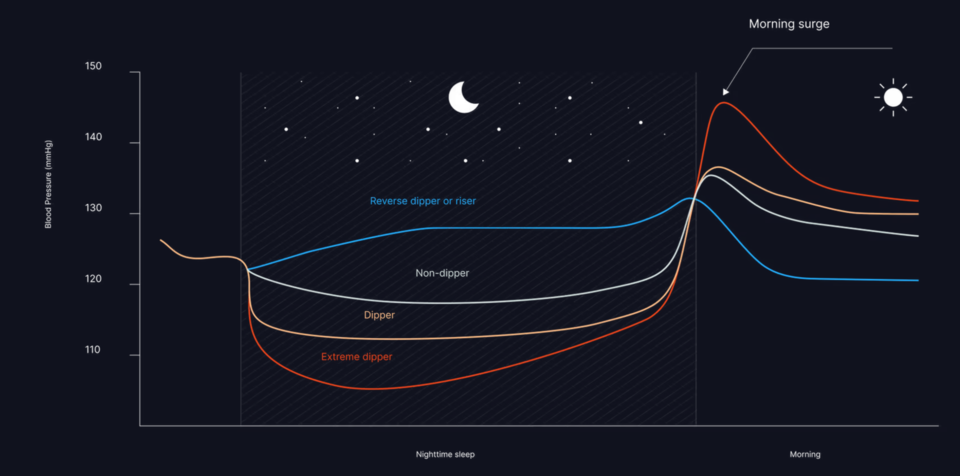 카트비피 프로로 측정한 야간 혈압 모니터링(자료=스카이랩스)