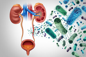 내성균 위협 속, FDA 마이셀 콘테포 승인 - 뉴스 썸네일 이미지